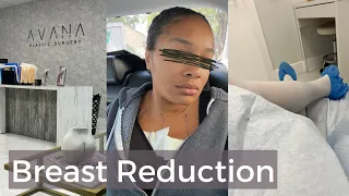 Breast Reduction | $ Cost | WHY? | 4 Weeks Post-Op