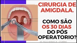 Cirurgia de Amigdala: Como é o primeiro mês do pós operatório?