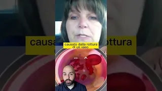 Si riprende in video mentre ha un ICTUS in diretta