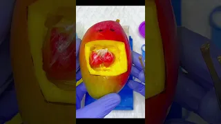 Mango Giving Twins Birth  Emergency Surgery #fruit #fruitsurgery