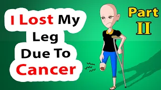 I Lost My Leg Due To Cancer - Episode 2