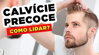 CALVÍCIE em HOMENS JOVENS? O que fazer com a Queda de Cabelo PRECOCE?