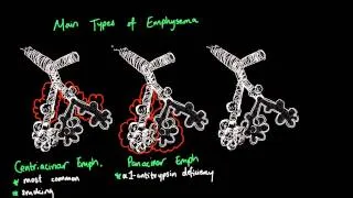 What is Emphysema?