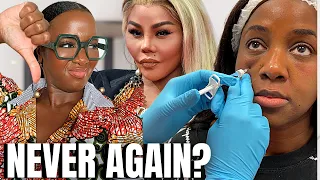 Under Eye Filler is NOT What You Think | Black Skin Care Over 40
