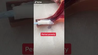 😕😕#period#periods_#periodpoverty_#poverty#tampon_#pad_#tampons #short