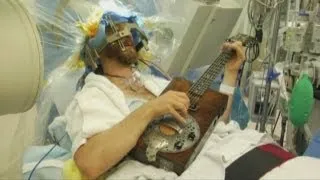 Patient plays guitar during brain surgery in Los Angeles