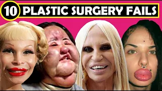 TOP 10 BOTCHED PLASTIC SURGERY FAILS - ( Plastic Surgery Before and After | FACE )