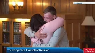 Minnesota woman meets transplant recipient who received deceased husband’s face