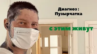 У меня диагноз пузырчатка #pemphigus