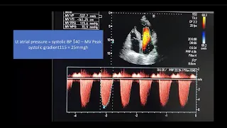 How to use the advanced critical care U/S in the proper management of acute respiratiry failure.