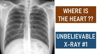 Where is the Heart? - Unbelievable X-ray #1