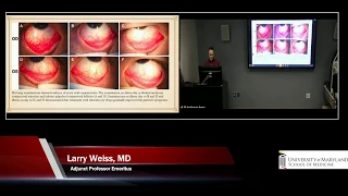 Ocular Emergencies - Victoria Hammond, MD