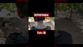 Trypophobia Ticks Part 2 #trypophobia #shorts #phobia