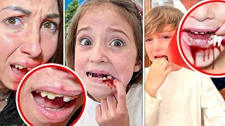 3 STORIE DI MAMMAGIULIA E FIGLIACHIARA CHE SI STACCA IL DENTE CON FIGLIODIEGO E DENTE ROTTO!