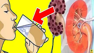 These 8 things are destroying your kidneys.