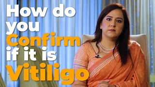 Dr Nitika Kohli Reveals 3 Ways To Confirm If Its Vitiligo