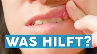 Tipps zur Mundpflege: Das hilft gegen Aphthen