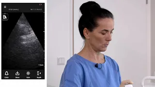 How to Perform an AAA Ultrasound