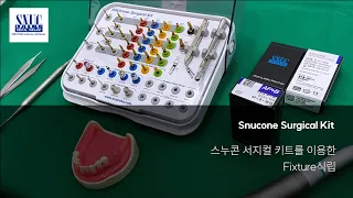 [Snucone Surgical Kit] Fixture식립 사용방법 -1부