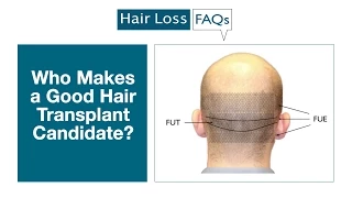 Who Makes a Good Hair Transplant Candidate?