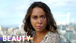 My Cleft Scars Are My Favourite Feature | SHAKE MY BEAUTY