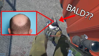 NEW CS UPDATE made my HAIRLINE RECEDE???