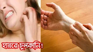 এলার্জি থেকে সম্পূর্ণ মুক্তি শুধুমাত্র প্রাকৃতিক পদ্ধতিতেই সম্ভব। 10 Natural Ways to Cure Allergy