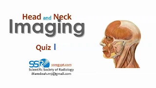 21 Head and Neck quiz -  prof.Mamdouh Mahfouz (2019 edition)