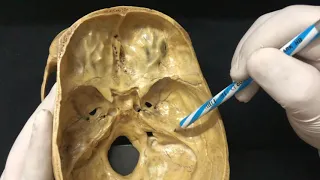 Skull Osteology - Cranial Cavity Anatomy