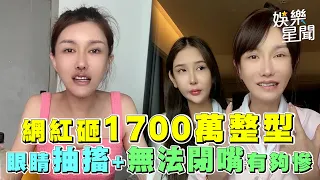 網紅砸1700萬整型 眼睛抽搐+無法閉嘴有夠慘｜祝你健康