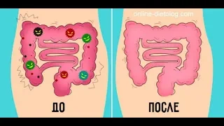 Нужно ли очищение кишечника?