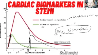 ACS UNSTABLE ANGINA, NSTEMI, STEMI, CARDIAC BIOMARKERS Troponin, CK-MB, Patient Assessment, Field Dx