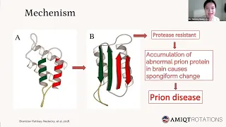 AMIQT - Dr Yumeng Huang,, PRION DISEASE