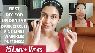 DIY for DARK CIRCLES, WRINKLES & PUFFINESS | Most Affordable & Results in 2 Weeks | Chetali Chadha