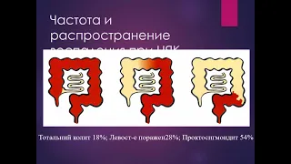 Воспалительные заболевания кишечника