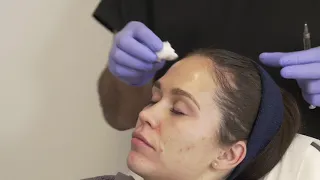 Face and Hair rejuvenation using Cellenis PRP