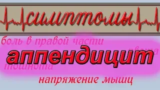 Аппендицит. Симптомы.