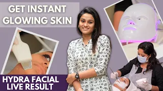 Instant Glowing Skin In One Day | Hydra Facial | Before & After | Best Facial For Brides