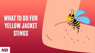 What To Do For Yellow Jacket Stings