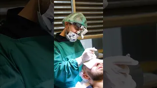 HAIR TRANSPLANT DAY OF A PATIENT