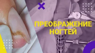 ПРОТЕЗИРОВАНИЕ ногтей 💅 Наращивание ногтей в ОДНУ каплю 💜 РЕВЕРСИВНЫЙ стемпинг