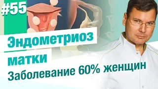 Что такое эндометриоз матки?