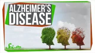 How Close Are We to Curing Alzheimer's?