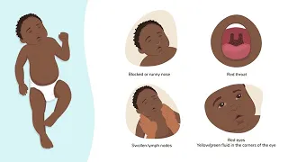 How to Assess a Child with a Cough