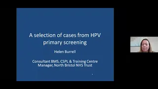 HPV Primary cases presented by Miss Helen Burrell BAC Executive