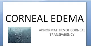 Ophthalmology 142 Corneal Edema keratopathy bullous Fuchs dystrophy 5% NaCl anhydrous glycerine