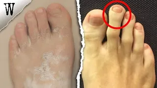 FOOT SHAPE ANCESTRY You Shouldn't Ignore