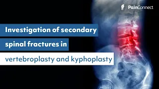Risk of New Secondary Spine Fractures after Vertebroplasty and Kyphoplasty