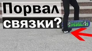 ПОДВЕРНУЛ НОГУ НА СКЕЙТЕ | ПОРВАЛ СВЯЗКИ?