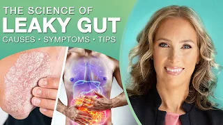 The Science of Leaky Gut : Everything You Need to know About Leaky Gut